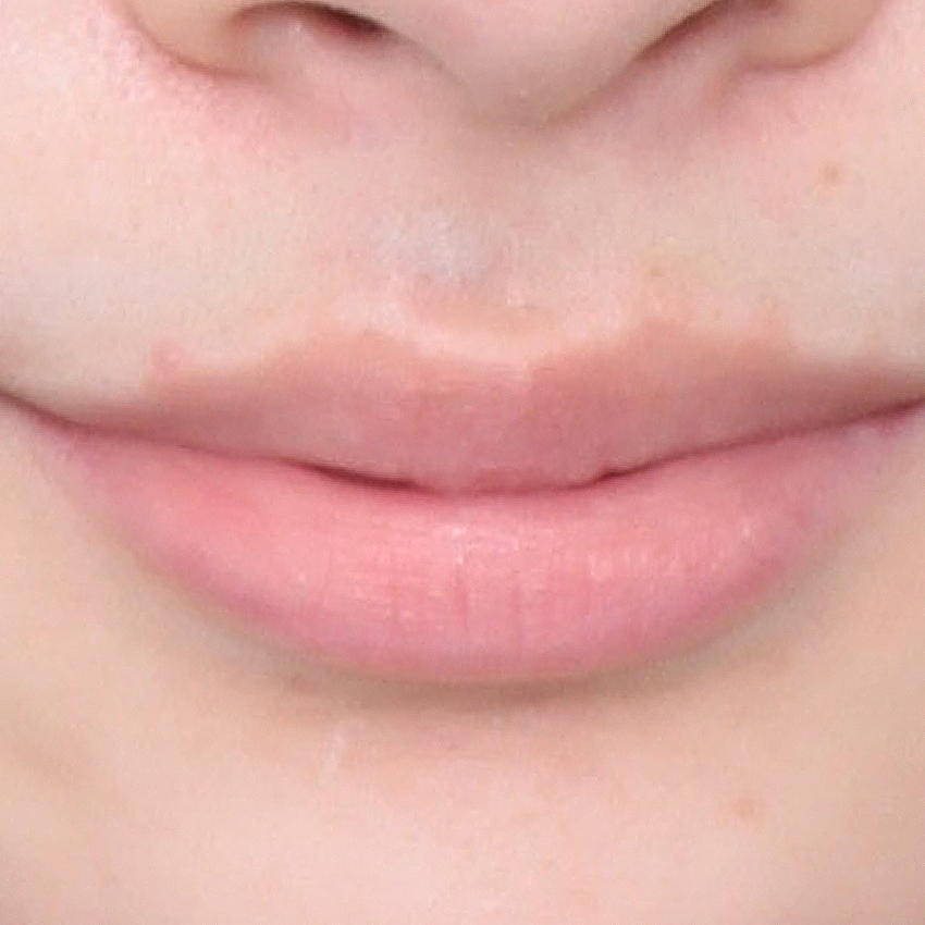 リップ before